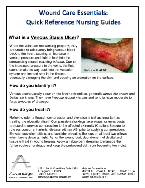 What is a Venous Stasis Ulcer?